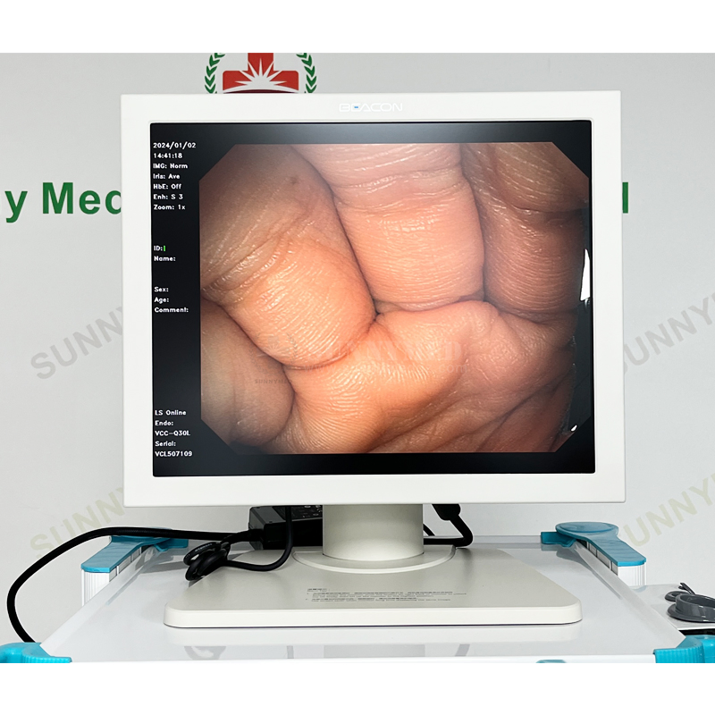 Top Quality Aohua Aq-100 Flexible Endoscopy Gastroscope Colonoscope Camera System