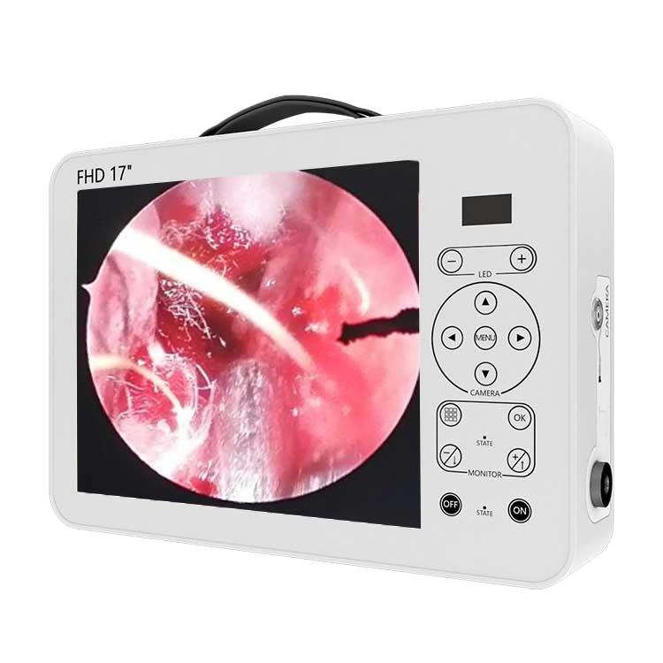 Portable Laparoscopy Endoscope Medical Equipment Endoscopy Camera Image System