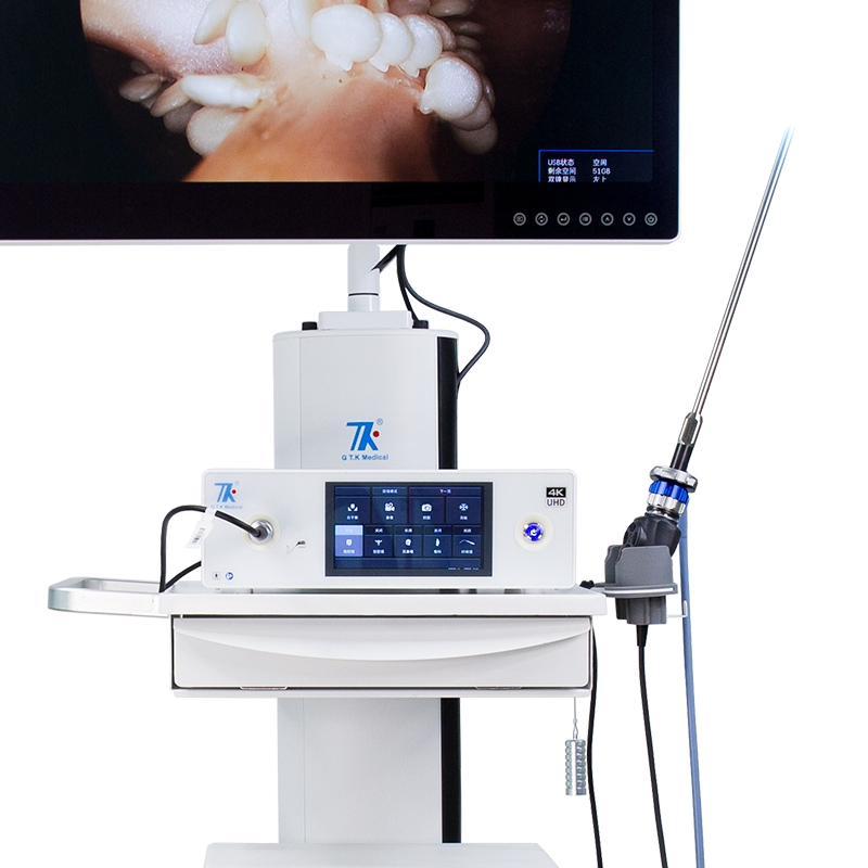 New Design Flexible Endoscopy System Video Gastroscope Ent Camera System with Light Source