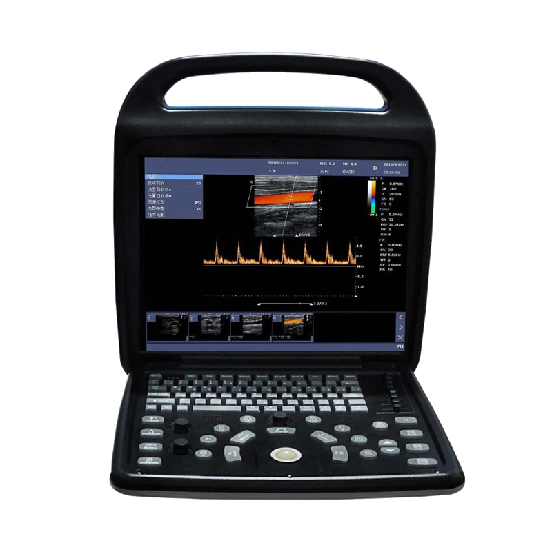 Portable Compact Color Doppler Ultrasound Imaging System--Advanced Imaging for Human &amp; Veterinary Use