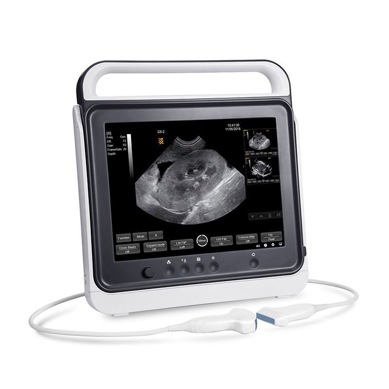 My-A012-N Touch Screen Black and White Portable Veterinary Medical Ultrasound Instruments