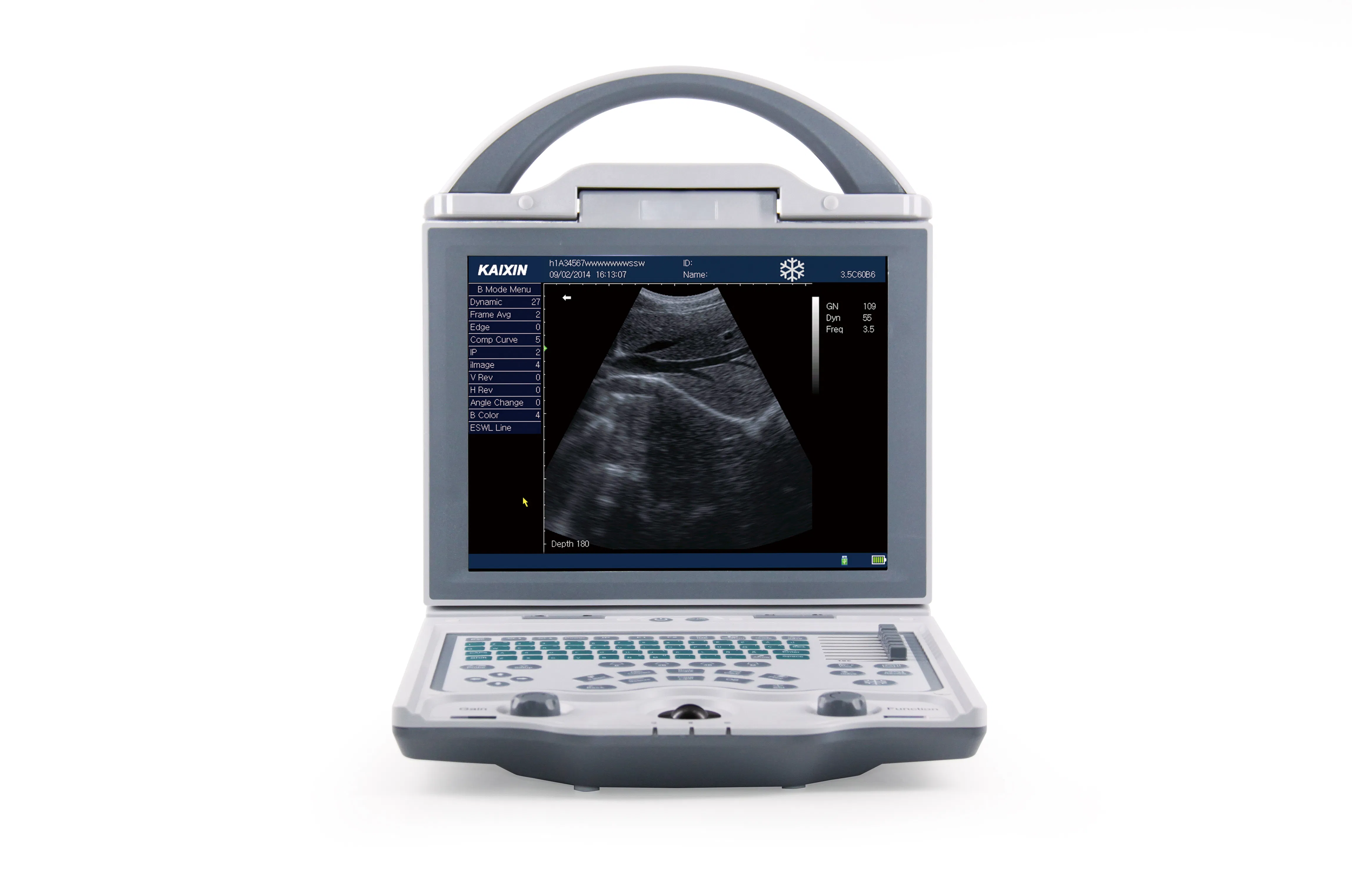 Veterinary Ultrasonic Diagnostic Instrument for Comprehensive Pet Clinic Use