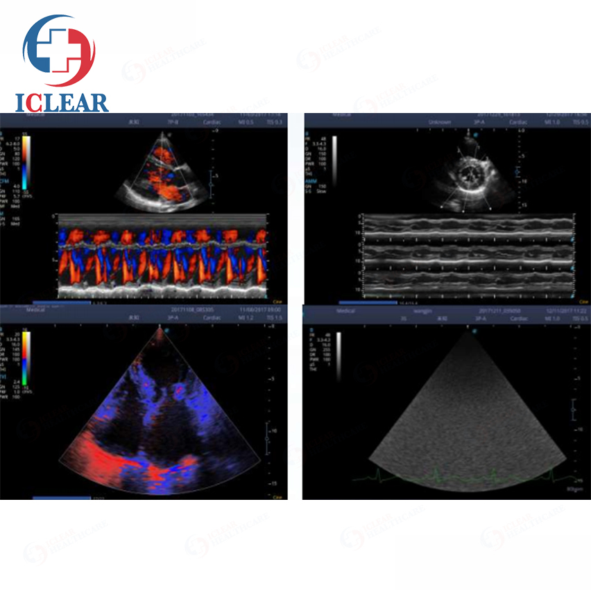 Portable Sonoscape Color Doppler Veterinary Ultrasound System