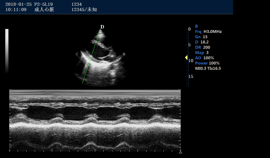 Cardiac Mode