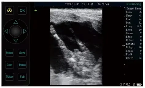 Ultrasound Display 2
