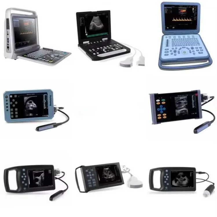 Veterinary Ultrasound Machine Details