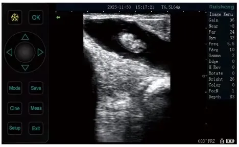 Ultrasound Display 1