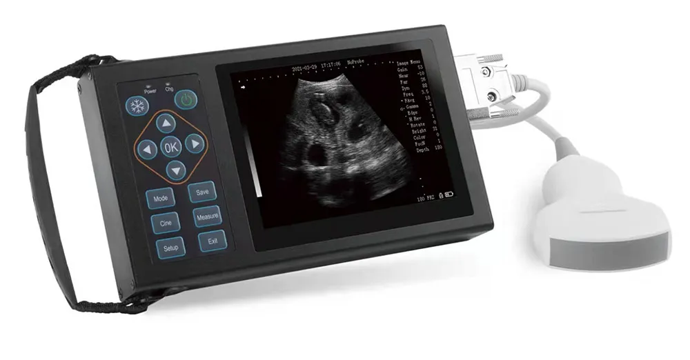 Ultrasound Equipment 1