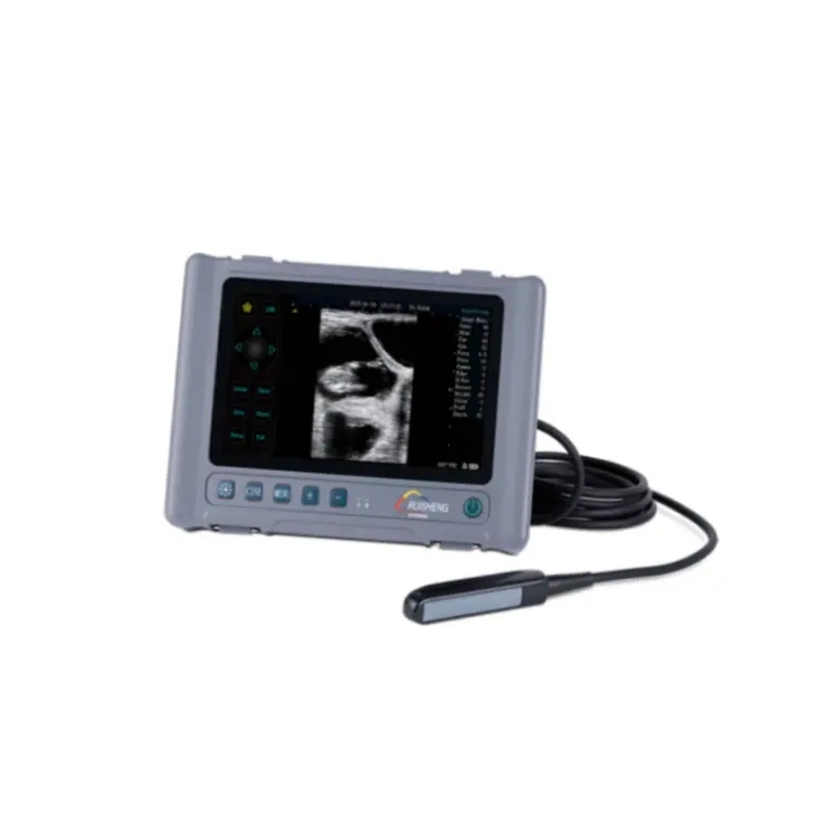 Portable Handheld Professional Palm Full-Digital Veterinary Ultrasound System Price