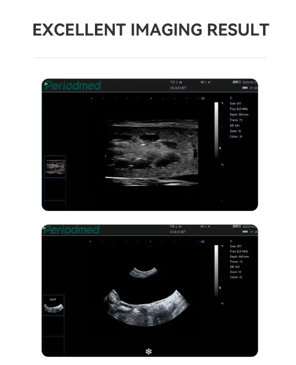 Ultrasound System Detail 3