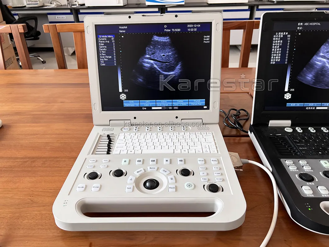 Vet Ultrasound View 2