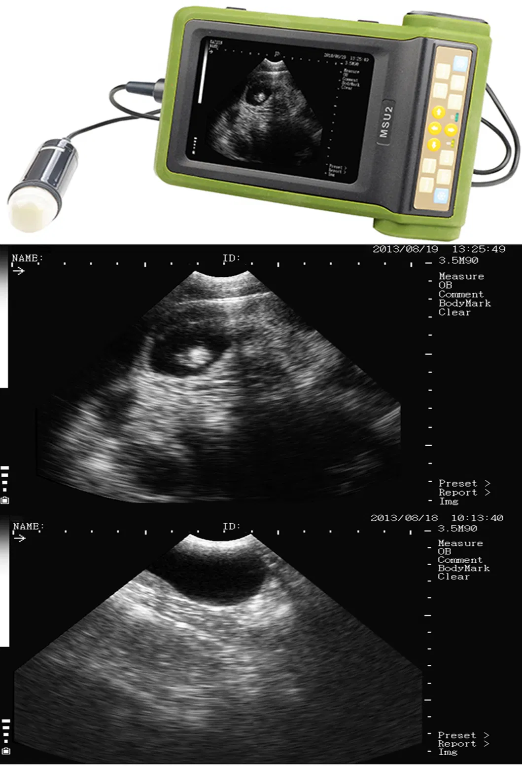 MSU-2 Ultrasonic Instrument