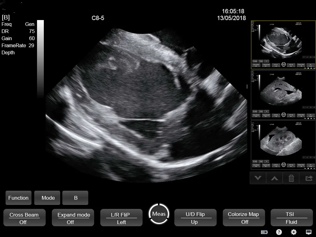 Ultrasound Interface 3