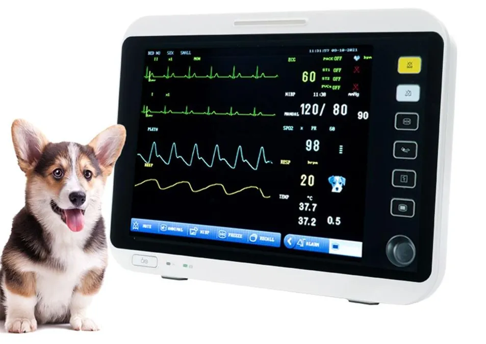 Respiration Monitoring