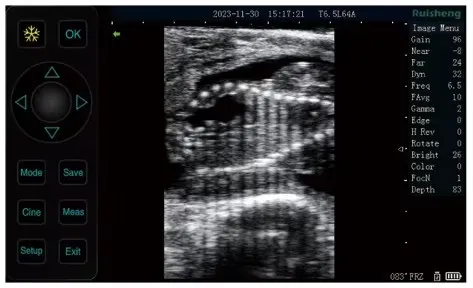 Ultrasound Display 4