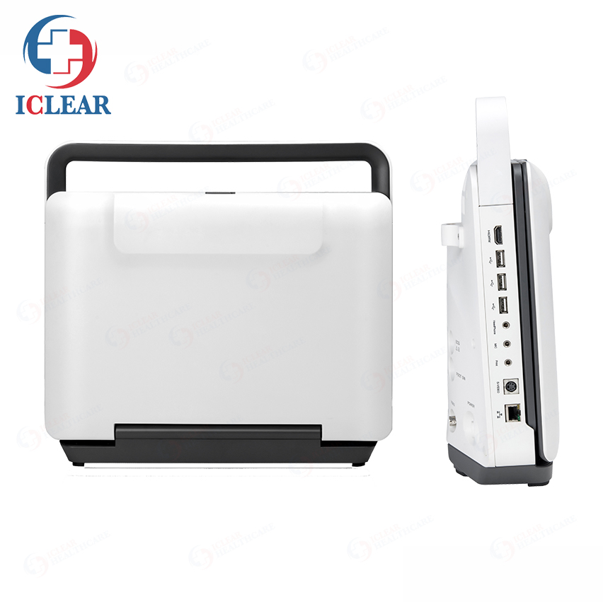 Portable Sonoscape Color Doppler Veterinary Ultrasound System