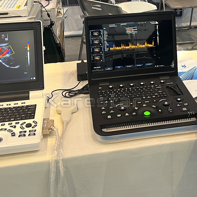 Price Diagnostic Ultrasound Vet Test Pregnancy Veterinary Ultrasound Machine