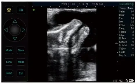 Ultrasound Detail 3