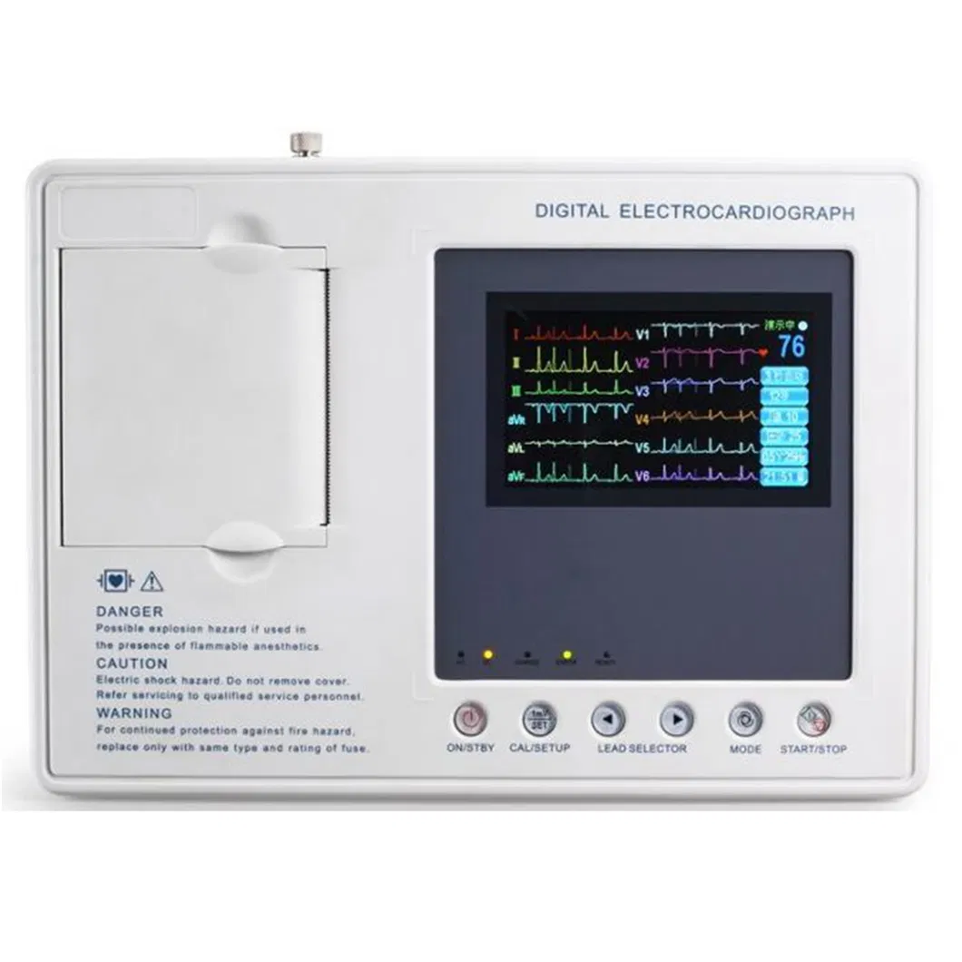 ECG Equipment