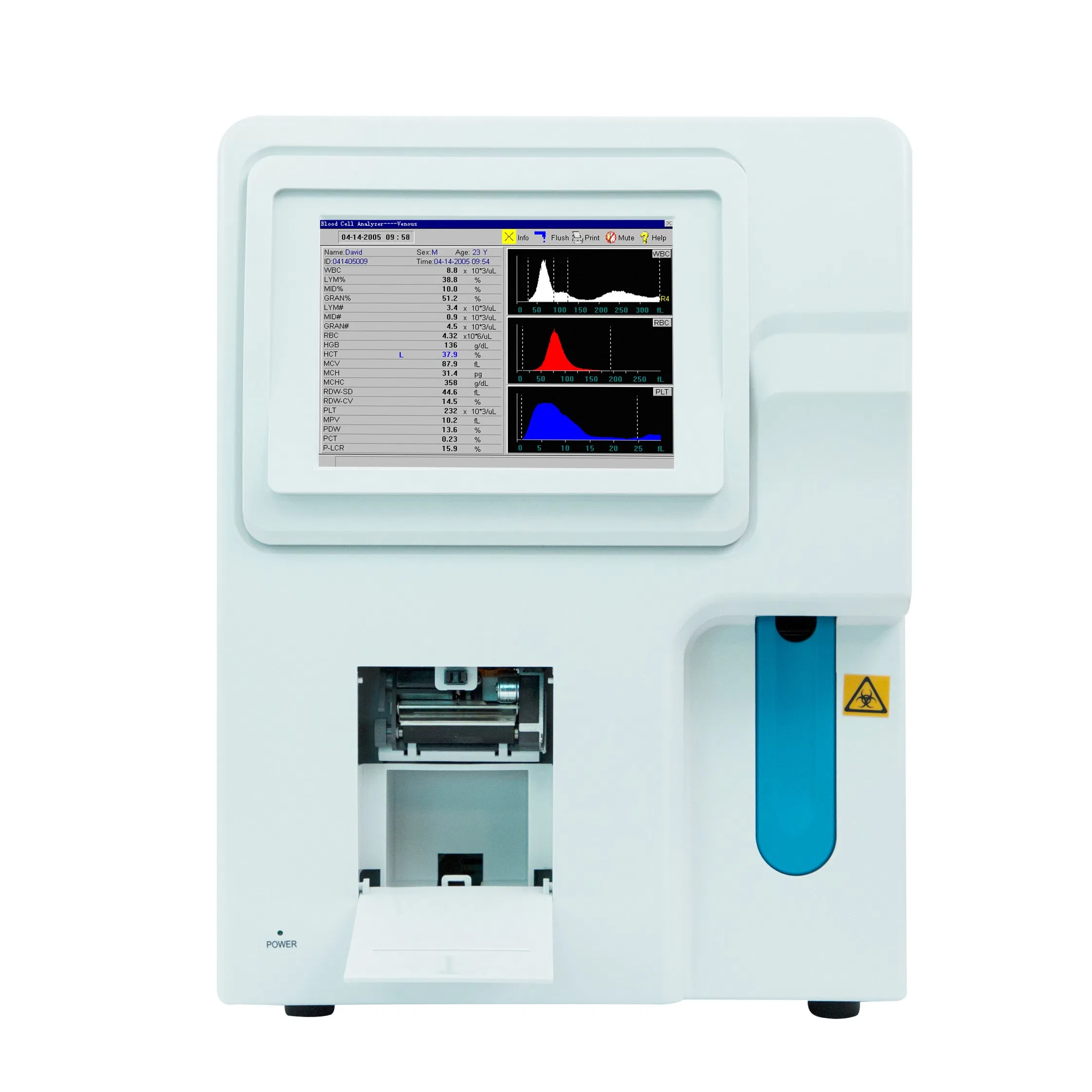 Soymed 3 Part Cbc Equipment/ Cheap Hematology Analyzer/ Veterinary Used Hematology Analyzer for Human