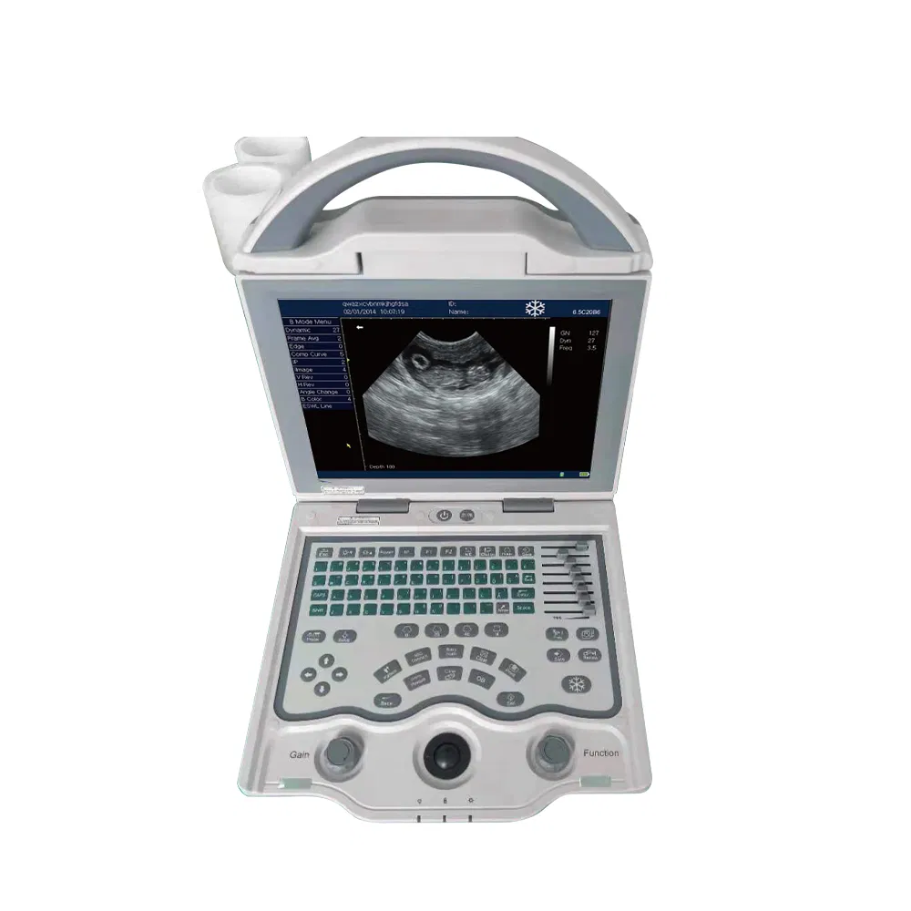 My-A013c Full Digital B Mode Ultrasonic Diagnostic Instruments for Veterinary