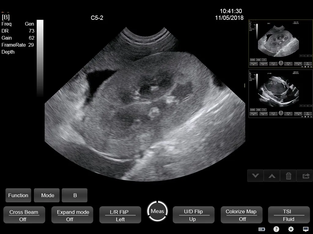 Ultrasound Interface 1