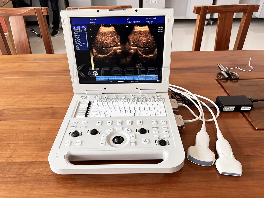 Vet Ultrasound View 1