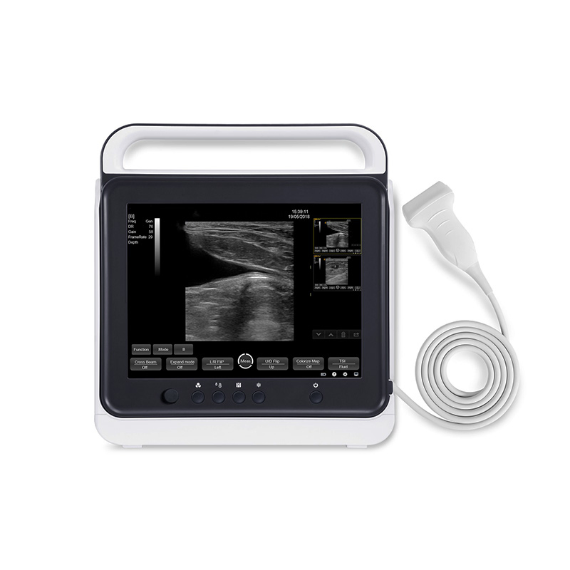 My-A012-N Touch Screen Black and White Portable Veterinary Medical Ultrasound Instruments