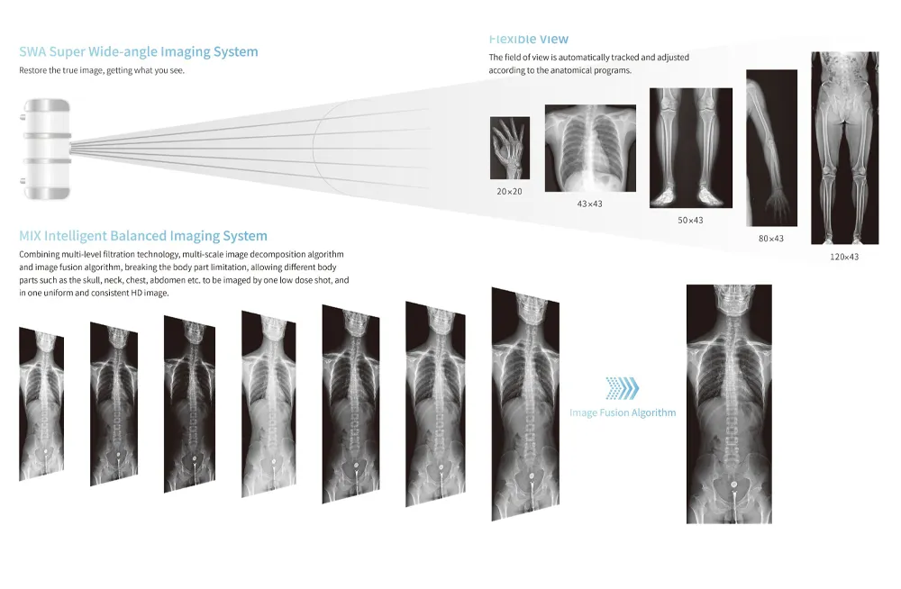 Digital Medical X-ray System 3