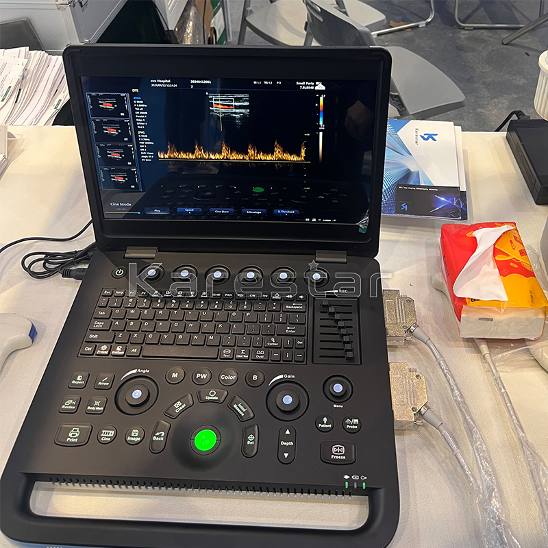 Price Diagnostic Ultrasound Vet Test Pregnancy Veterinary Ultrasound Machine