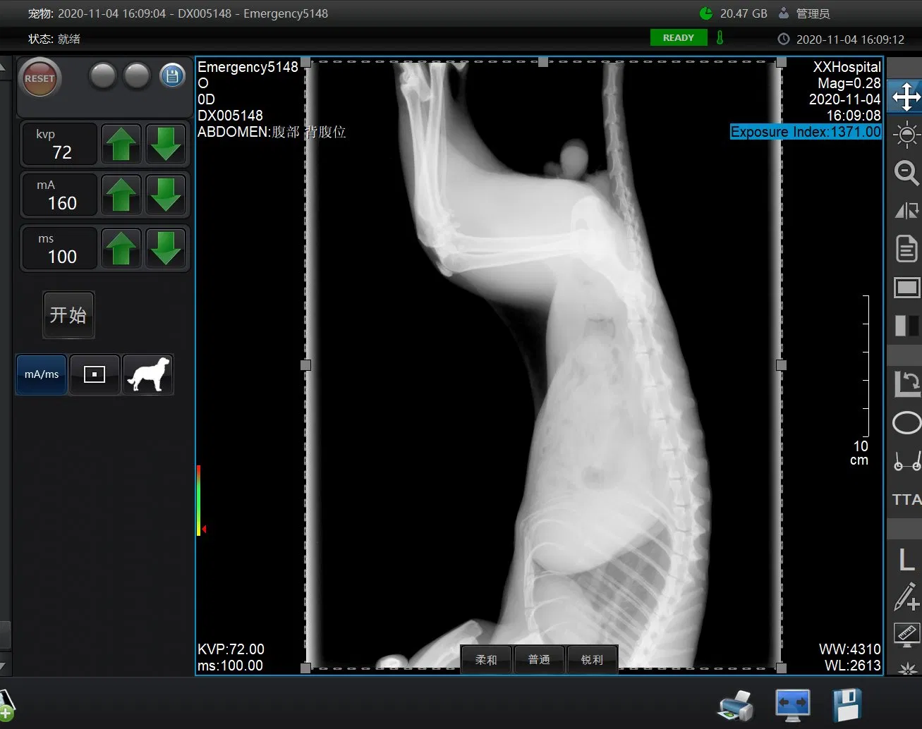 Iray Technology Mars1717V Veterinary Wireless Digital X-ray Flat Panel Detector Price Medical Equipment for Sale