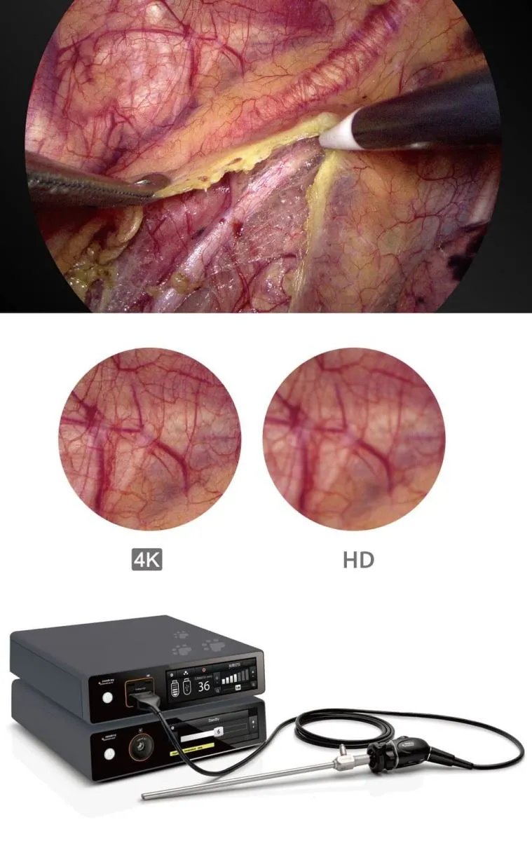 4K Rigid Endoscopy System