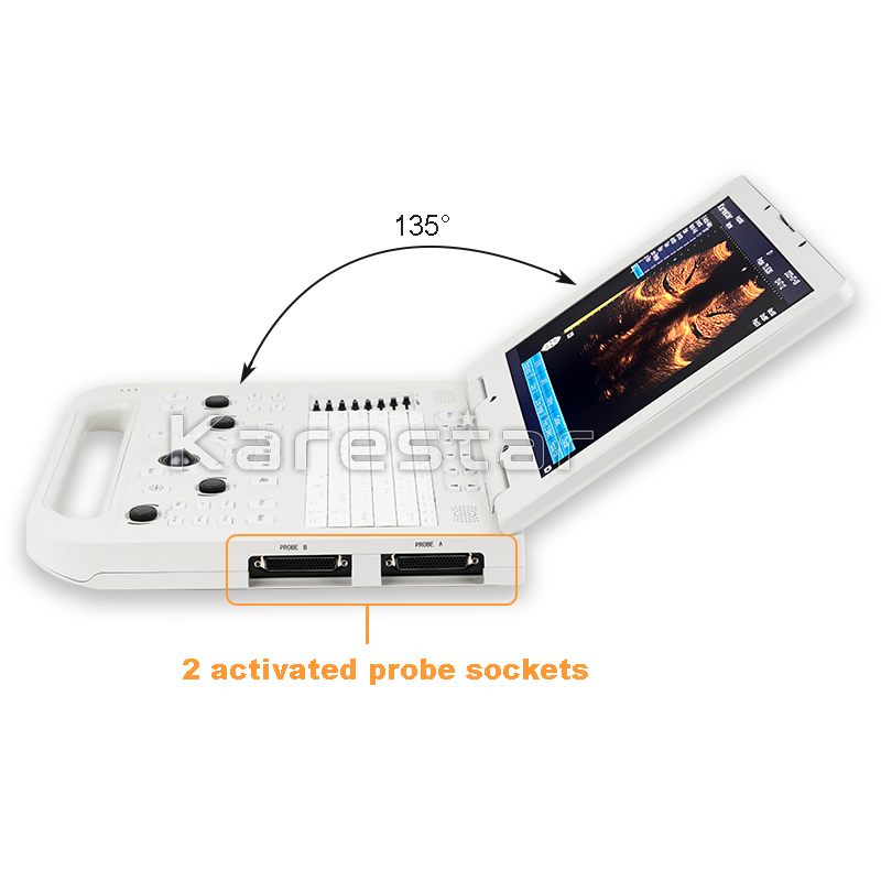 High Quality K-H301 Laptop Veterinary Ultrasonic Diagnostic Instrument Price Vet