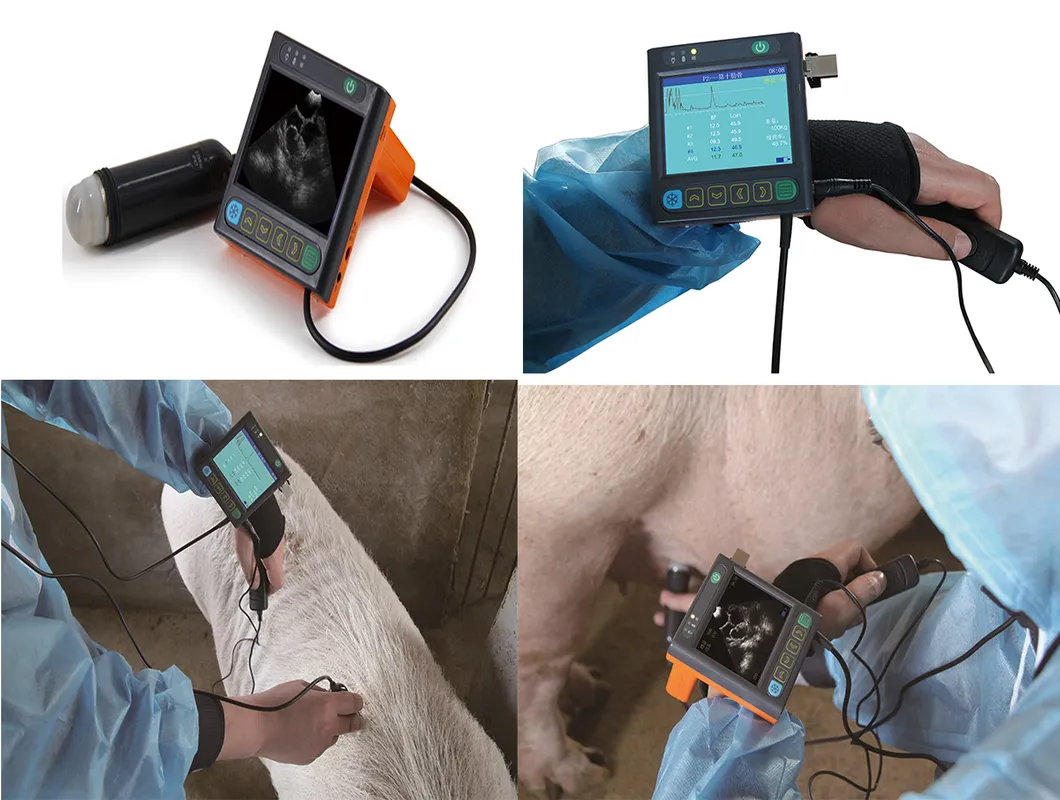 MSU-3 Ultrasound Main Unit