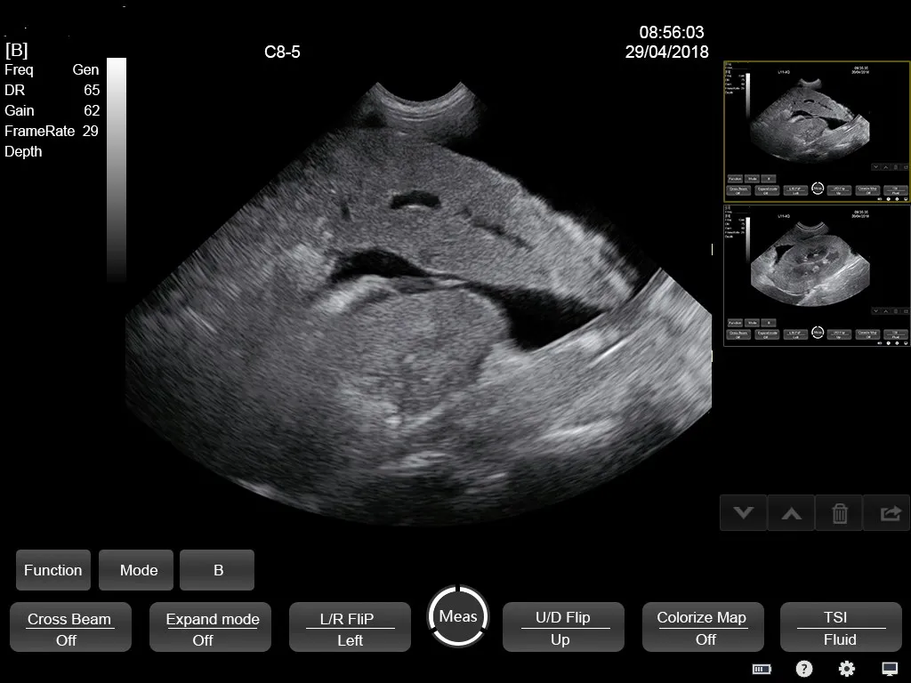 Ultrasound Interface 2