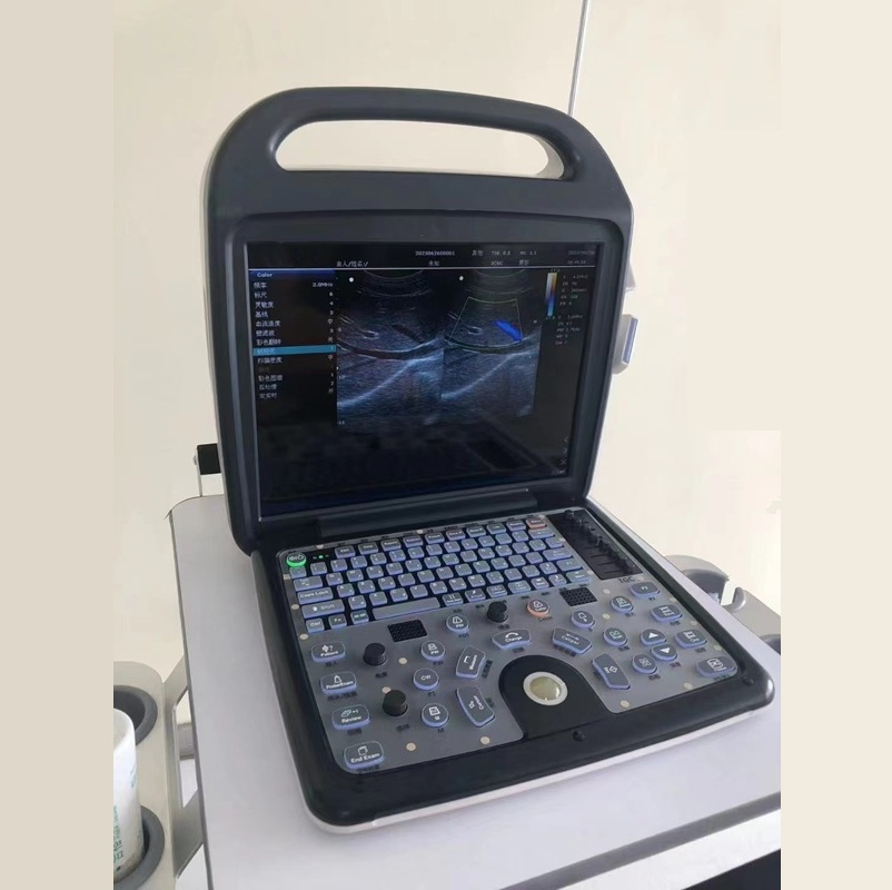 Portable Compact Color Doppler Ultrasound Imaging System--Advanced Imaging for Human &amp; Veterinary Use