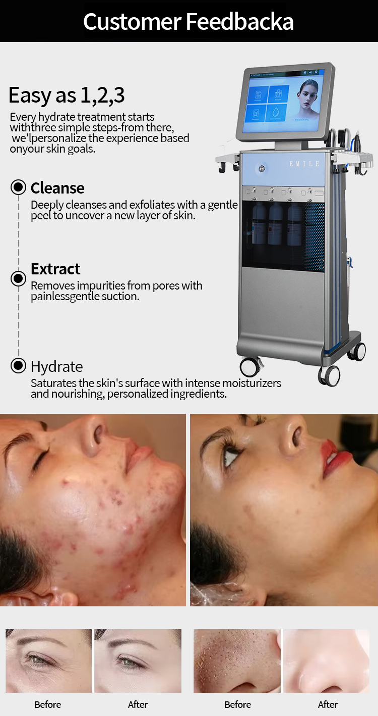 Treatment Process 2