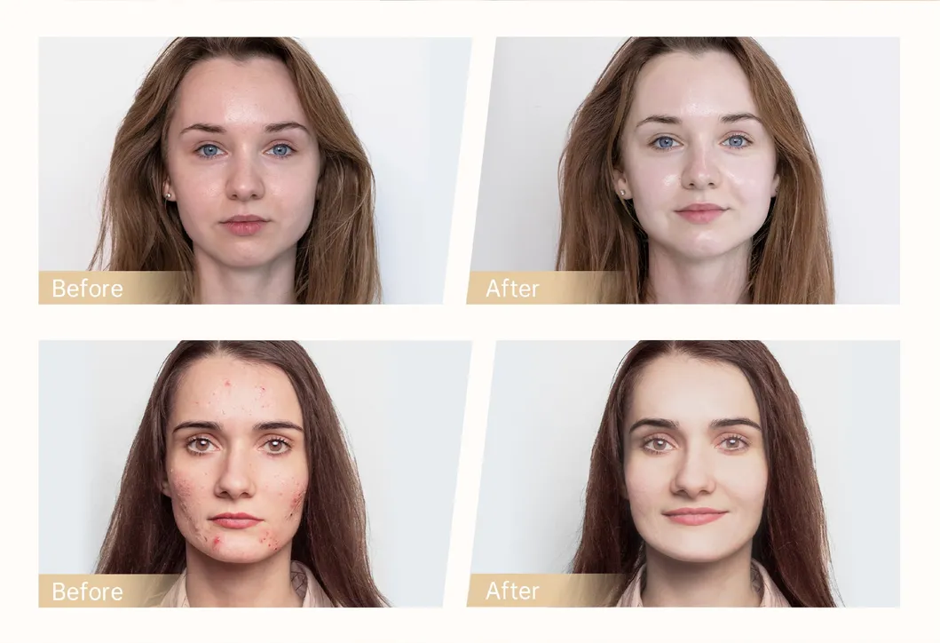 Before and After Treatment Results