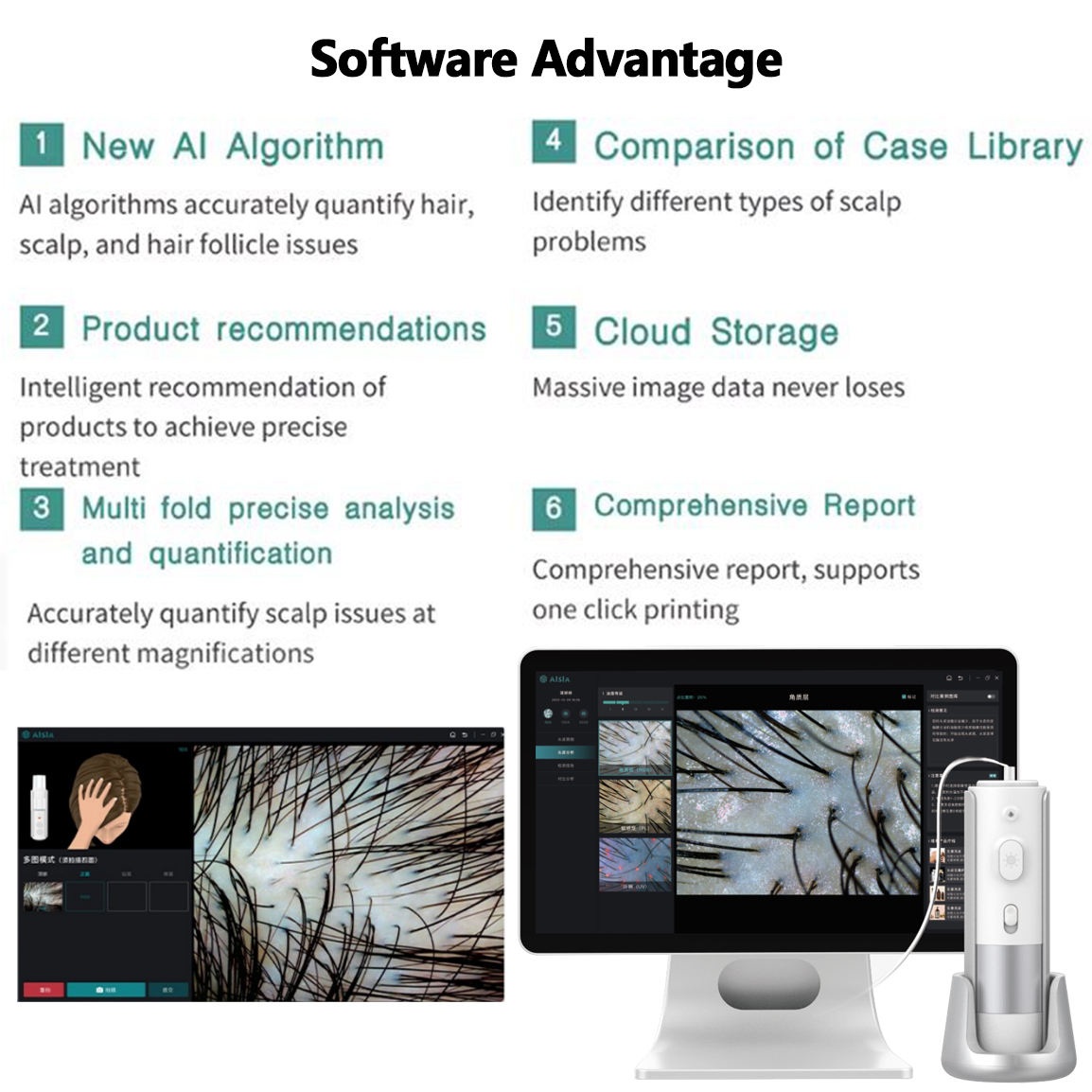 Ai Smart Hair and Scalp Analyzer 16Mp Hd Camera 10X-200X Zoom for Accurate Hair Follicle &amp; Scalp Sensitivity Diagnosis