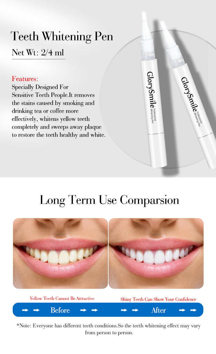 Teeth Whitening Kit Image 5