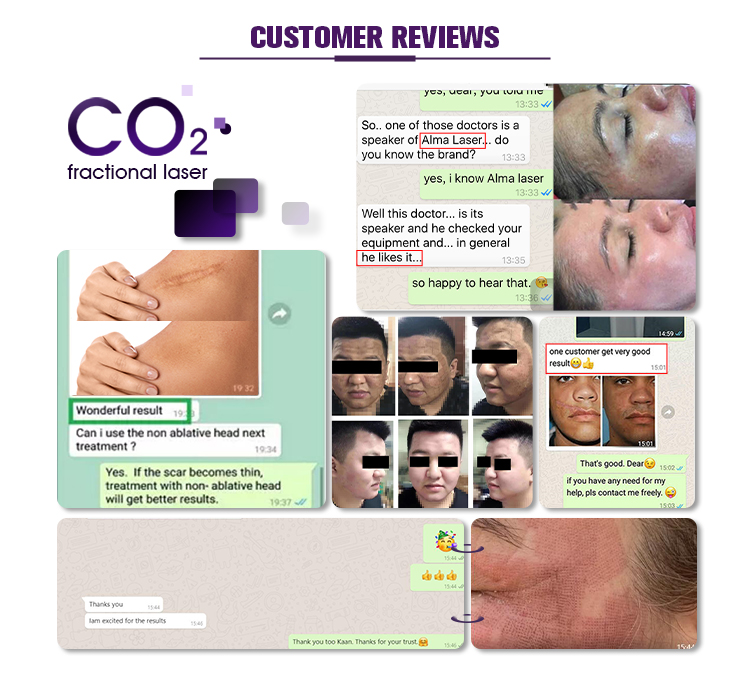 Customer reviews
