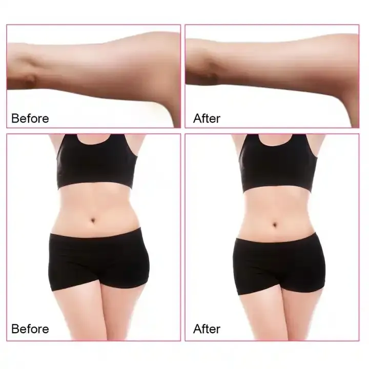 40kHz Cavitation Ultrasonic Body Slimming Machine RF Facial Massager Skin Tighten Face Lifting Skin Care Tool