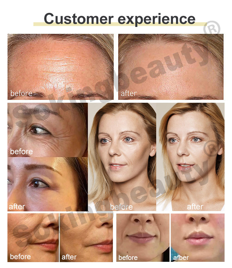 Before and After Treatment Results