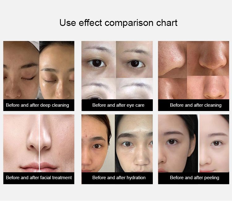 High Quality Facial Deep Cleansing Machine With 14 Functions Technology for Beauty Total Beauty Care Large Bubble Integrated