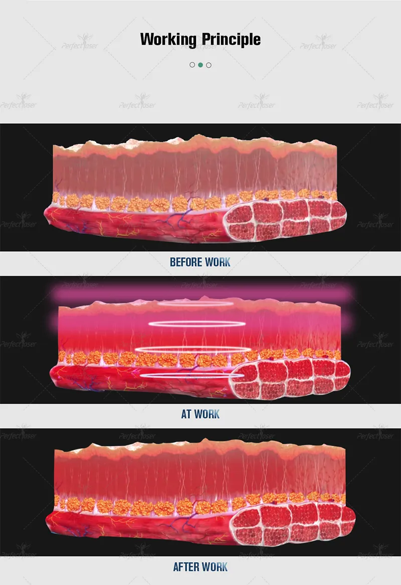 Revitalise Anti-Aging Remove Wrinkles RF Facial Lifting Massager