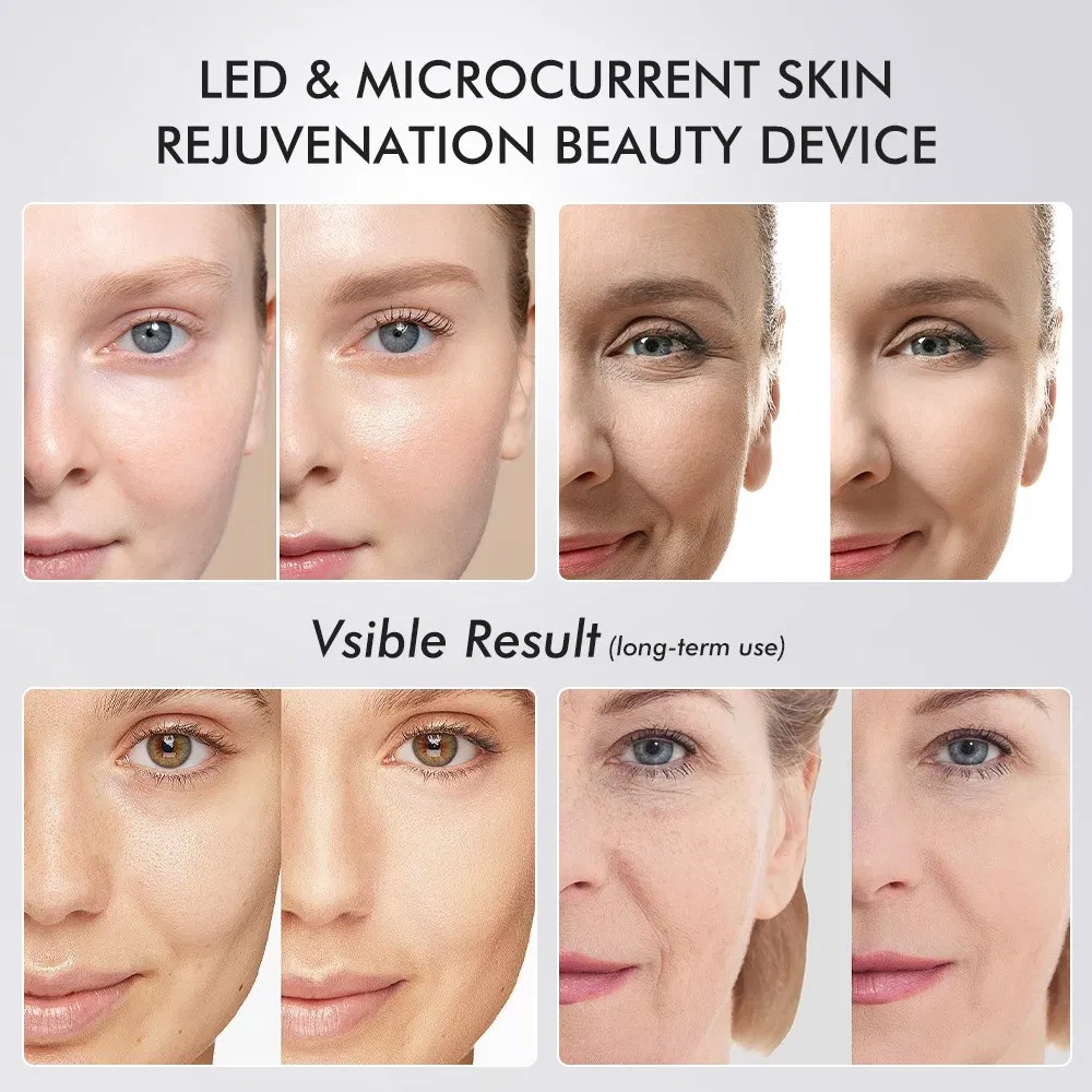 EMS Microcurrent Facial Massager Product Photo