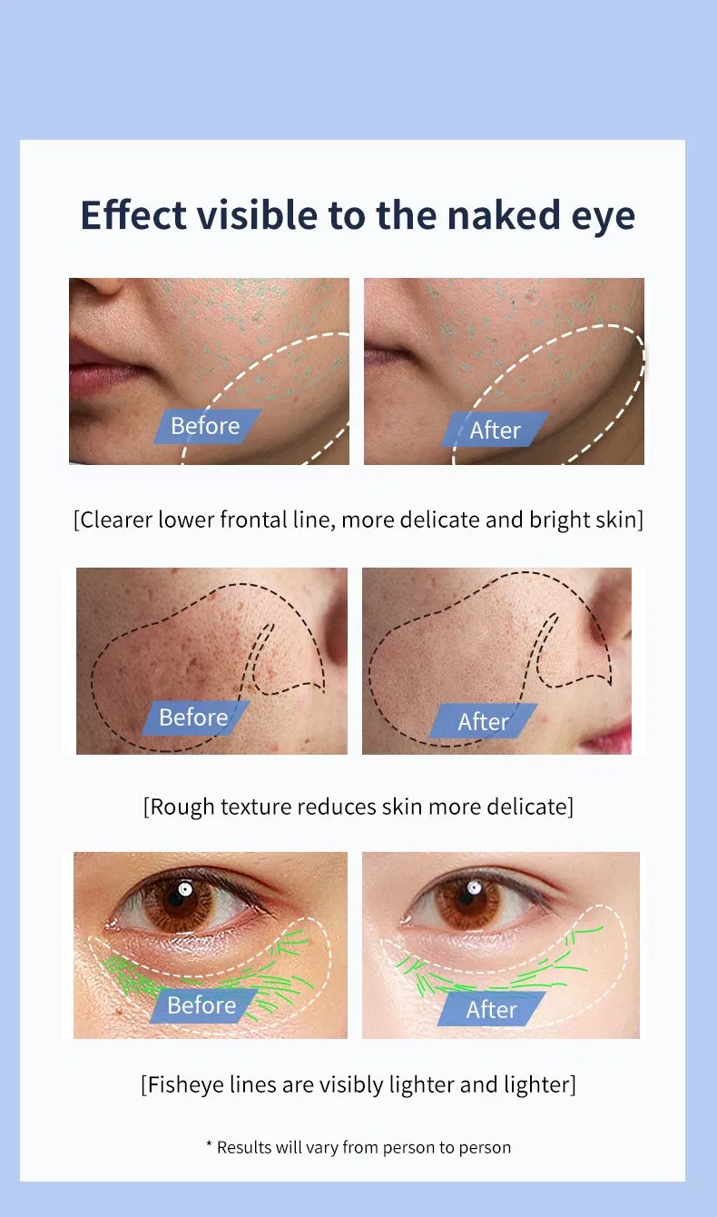 Professional Home Use Beauty Equipment RF Microcurrent Multifunctional Facial Skin Care Device