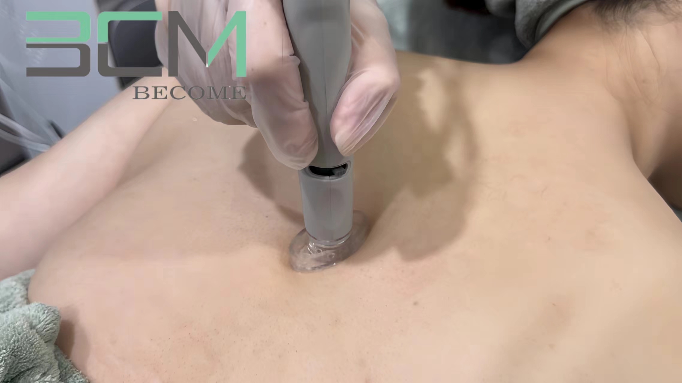 Deep cleansing of the back