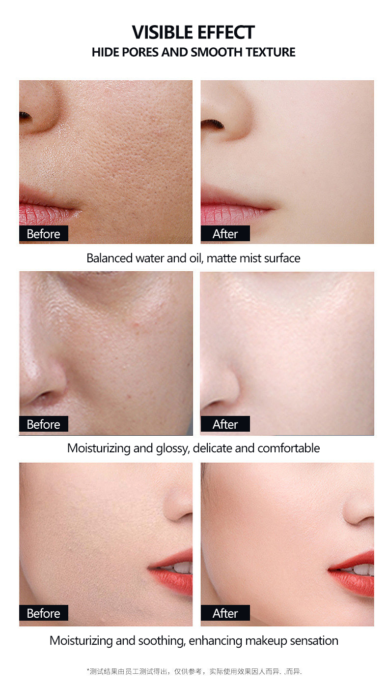 Portable Multifunctional Heating Cooling Facial Equipment LED Light Therapy RF Face Lifting EMS Anti-aging Face Massage