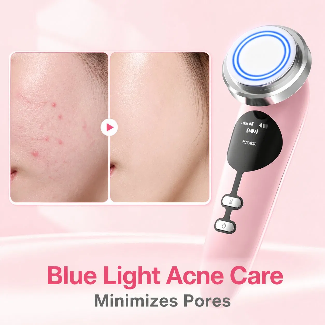 [Zsm] Pocket Size Rechargeable Facial Neck Tightening Home Beauty Instrument Handheld Beauty Device